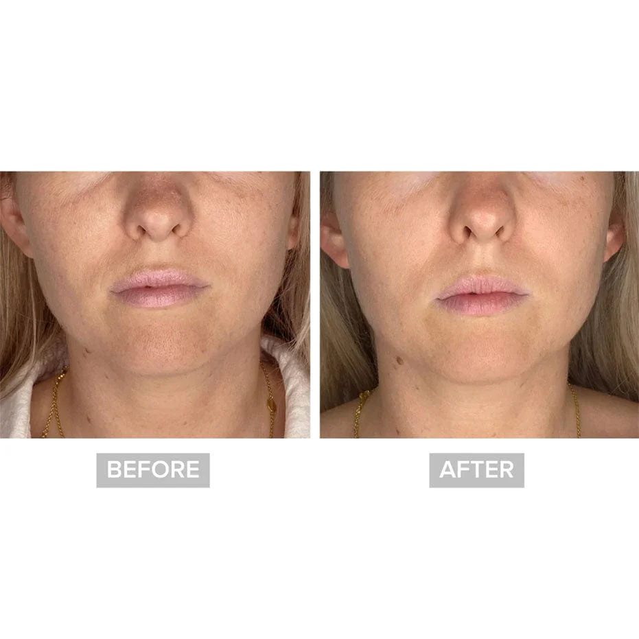 Retreatment Botanics Ageless AHA Glow Concentrate - Image 3